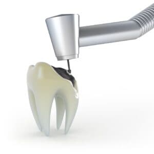 General Dental Supplies